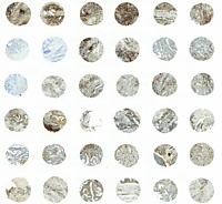 Molecular Pathology