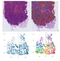 Spatial Transcriptomics